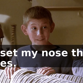 He set my nose three times.