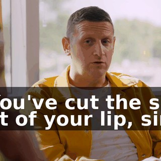 - You've cut the shit out of your lip, sir.