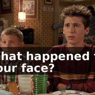 What happened to your face?