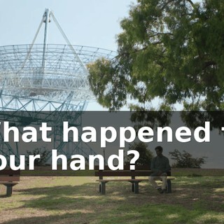 What happened to your hand?