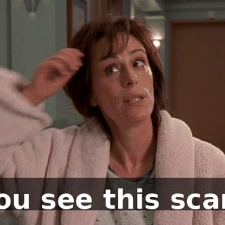 You see this scar?