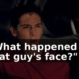 "What happened to that guy's face?"