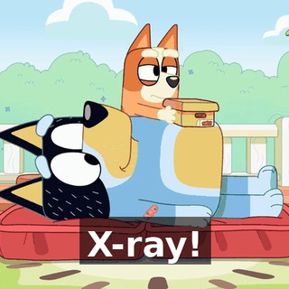 X-ray!