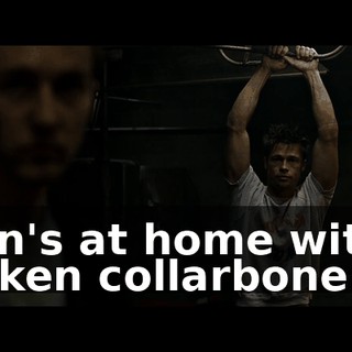 Irvin's at home with a broken collarbone.