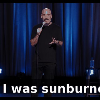 but I was sunburned."