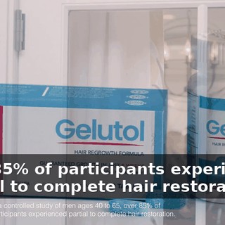 over 85% of participants experienced partial to complete hair restoration.
