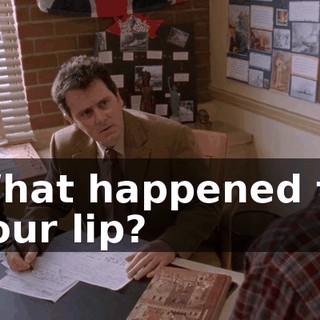 What happened to your lip?