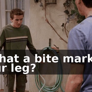 Is that a bite mark on your leg?