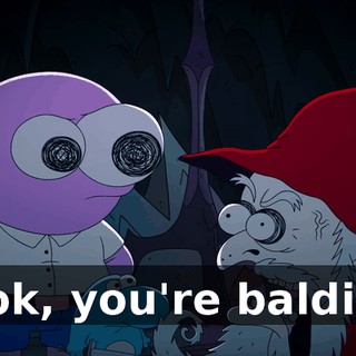 Look, you're balding,