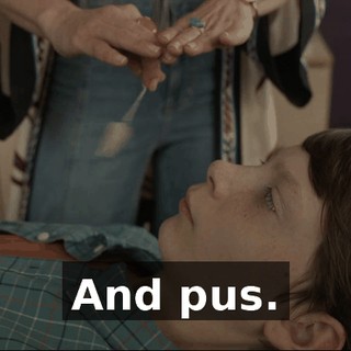 And pus.