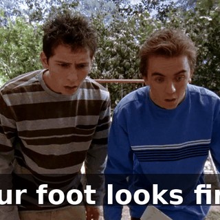 Your foot looks fine.