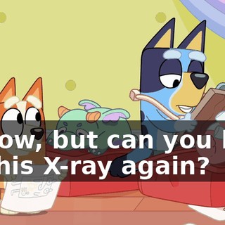 I know, but can you look at this X-ray again?