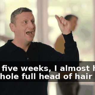 After five weeks, I almost had my whole full head of hair back.