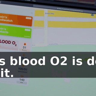 His blood O2 is dog shit.