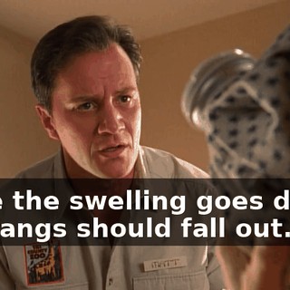 Once the swelling goes down, the fangs should fall out.