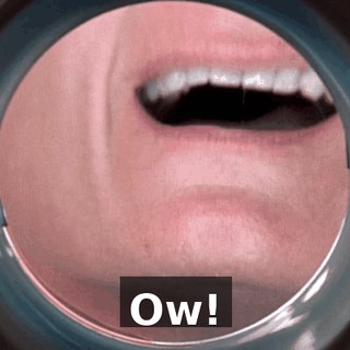 Ow!