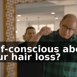 Self-conscious about your hair loss?