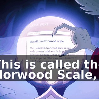 This is called the Norwood Scale,