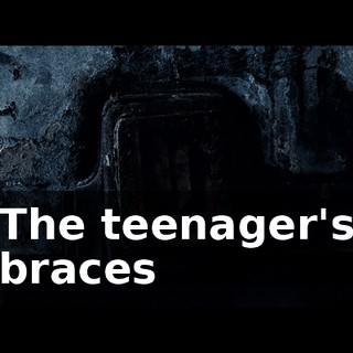 The teenager's braces