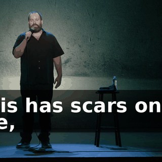 Chris has scars on his face,