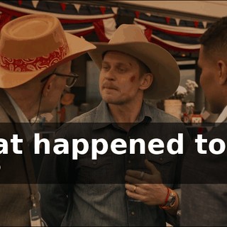- What happened to your face?