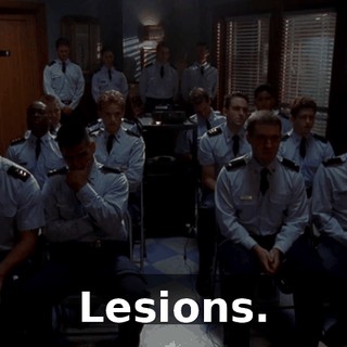 Lesions.