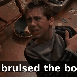 He bruised the bone.