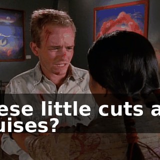 These little cuts and bruises?