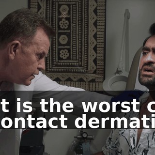 That is the worst case of contact dermatitis