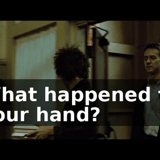 What happened to your hand?